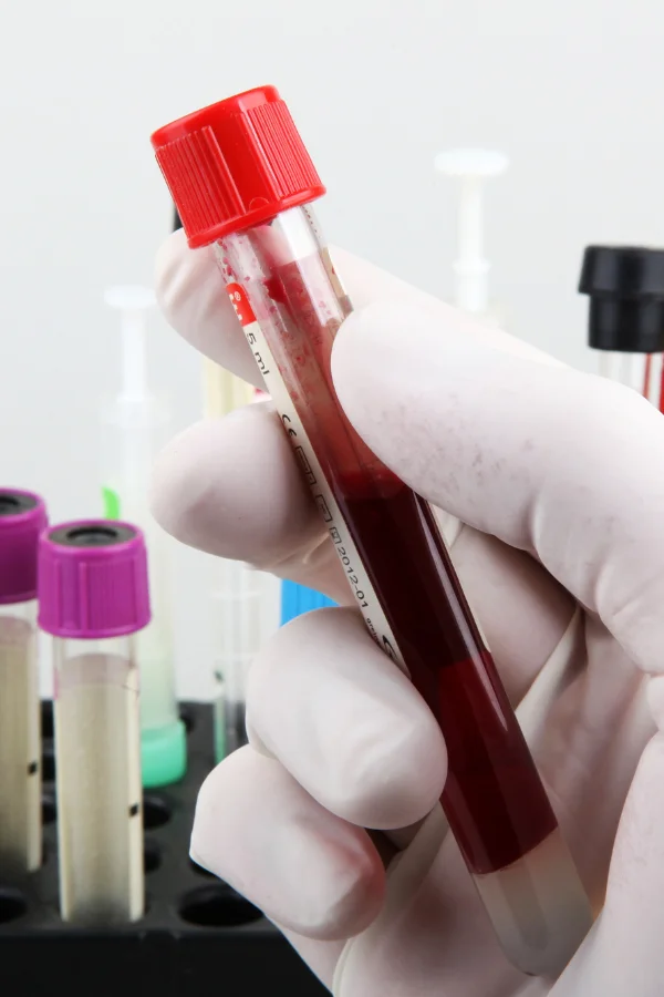 Prise de sang - Jv Care